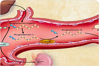 Aldosterone Pathophysiology Illustration