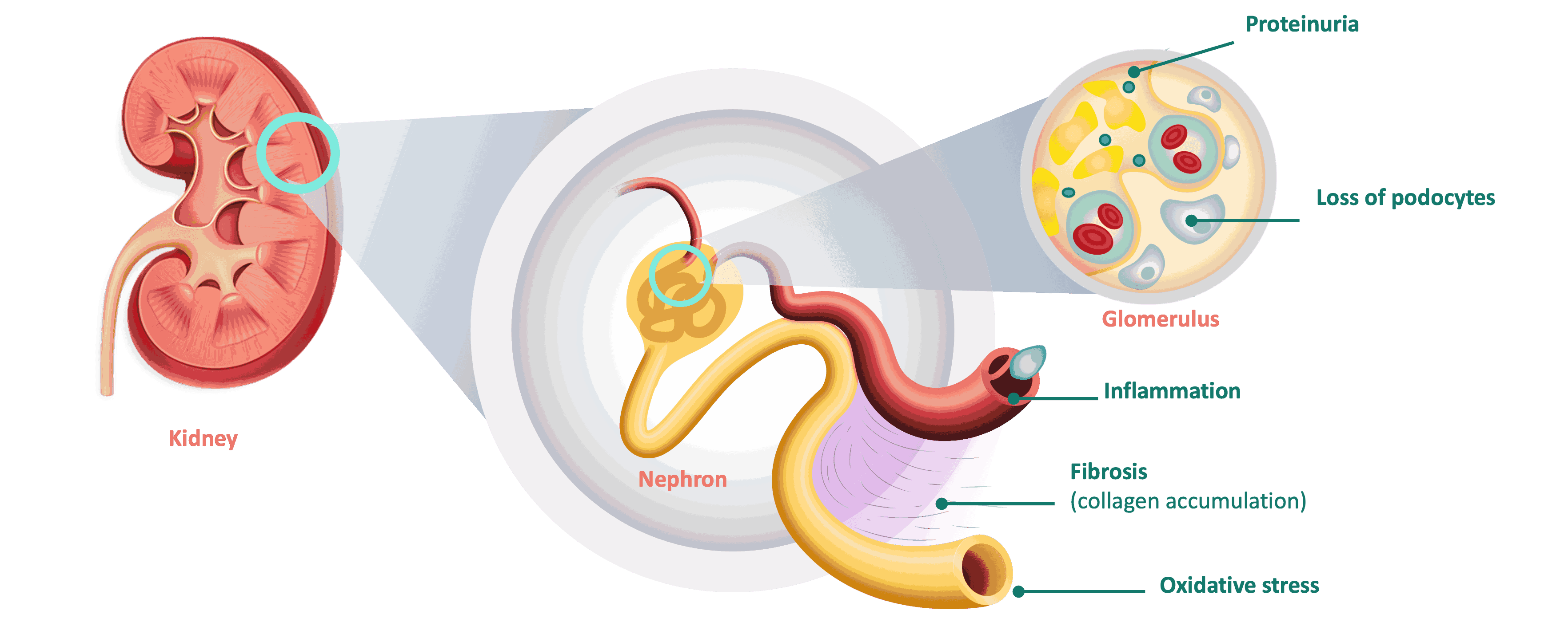 Structural Damage Beyond Electrolyte Homeostasis Infographic