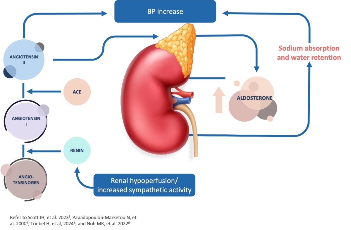 Precursors and Effects of RAAS Activation Infographic